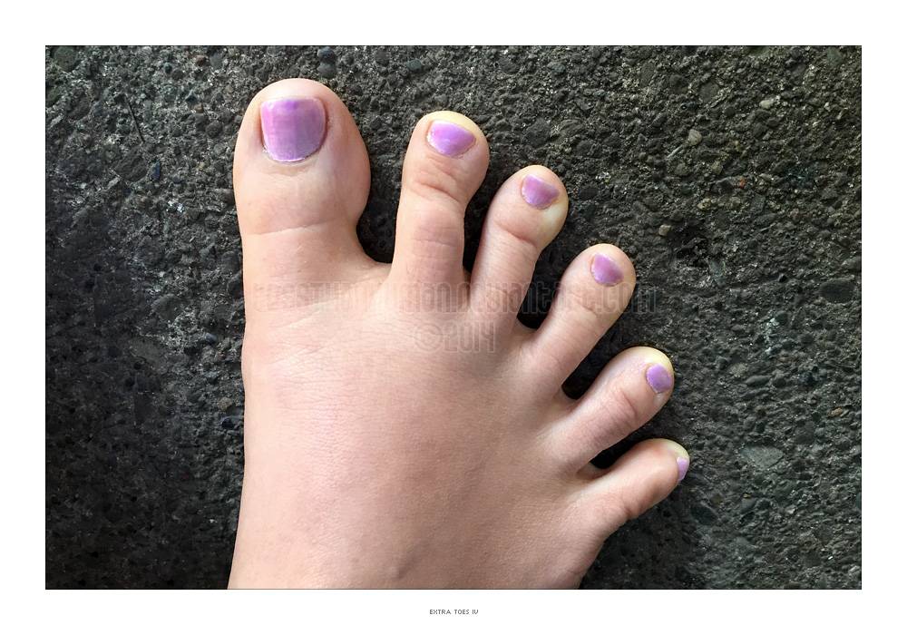 extra_toes_iv_by_lessthanhuman-d822o9r-jpg.jpg