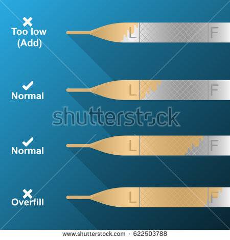 stock-vector-checking-and-read-oil-dipstick-in-vehicle-vector-622503788.jpg